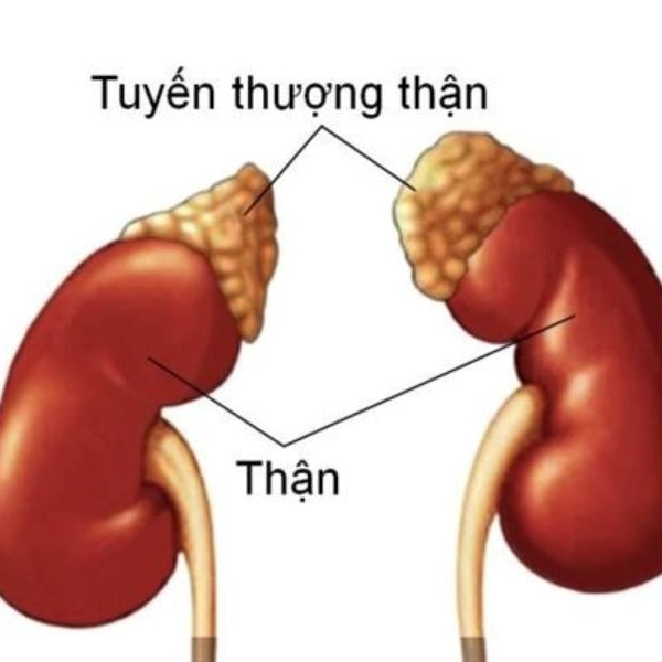 Ung thư tuyến thượng thận: Nguyên nhân, dấu hiệu và phương pháp điều trị