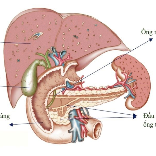 Dấu hiệu của căn bệnh ung thư tuyến tụy giai đoạn 2